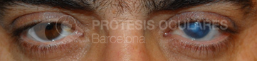 After image