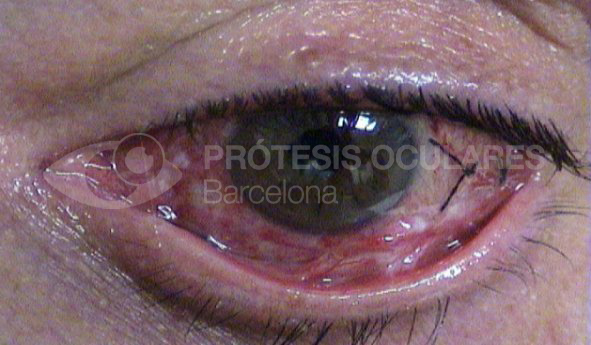After image