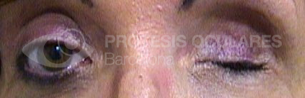 After image