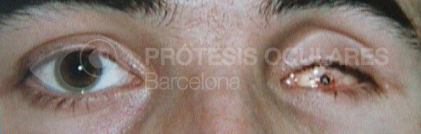After image