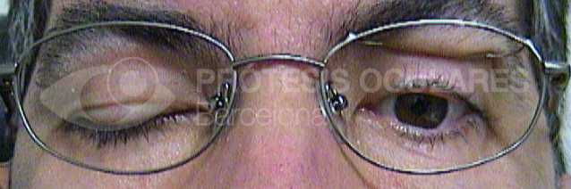 Before image